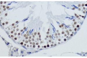 Immunohistochemistry of paraffin-embedded Rat testis using DiMethyl-Histone H4-K20 Polyclonal Antibody at dilution of 1:200 (40x lens). (Histone H4 antibody  (2meLys20))