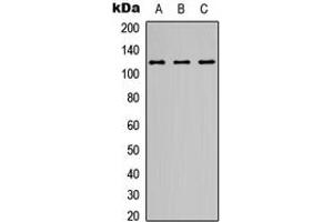 Western blot analysis of NMDAR1 expression in A549 (A), Y79 (B), Raji (C) whole cell lysates.