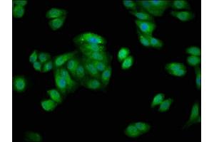 Immunofluorescence staining of HepG2 cells with ABIN7154867 at 1:66, counter-stained with DAPI. (HSP70 1A antibody  (AA 418-512))