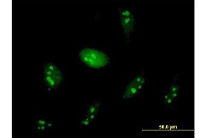 Immunofluorescence of purified MaxPab antibody to WDR74 on HeLa cell. (WDR74 antibody  (AA 1-366))