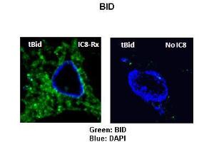 Sample Type: Rat thyrocytes-FRTL-5  Primary Antibody Dilution: 1:100 Secondary Antibody: Anti-rabbit-FITC  Secondary Antibody Dilution: 1:000 Color/Signal Descriptions: Green: BIDBlue: DAPI  Gene Name: BID Submitted by: Syed A Morshed, Mount Sinai School of Medicine and James J Peters VA Medical Center (BID antibody  (C-Term))