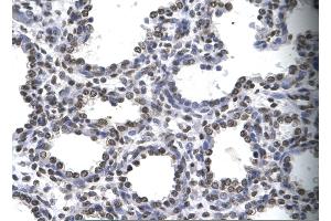 Rabbit Anti-MYEF2 Antibody       Paraffin Embedded Tissue:  Human alveolar cell   Cellular Data:  Epithelial cells of renal tubule  Antibody Concentration:   4. (MYEF2 antibody  (Middle Region))