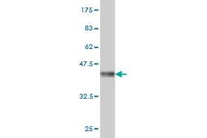 Western Blot detection against Immunogen (33. (MAGEA3 antibody  (AA 44-114))