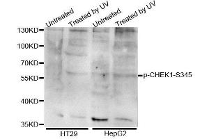 Western blot analysis of extracts of various cell lines, using Phospho-CHEK1-S345 antibody (ABIN5995617). (CHEK1 antibody  (pSer345))