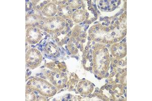Immunohistochemistry of paraffin-embedded rat kidney using H6PD antibody (ABIN5973840) at dilution of 1/200 (40x lens). (Glucose-6-Phosphate Dehydrogenase antibody)