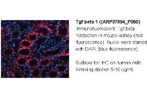 Image no. 2 for anti-Transforming Growth Factor, beta 1 (TGFB1) (Middle Region) antibody (ABIN2780306) (TGFB1 antibody  (Middle Region))
