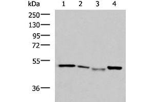 Western blot analysis of HepG2 cell Hela cell Mouse kidney tissue K562 cell lysates using NFS1 Polyclonal Antibody at dilution of 1:800 (NFS1 antibody)