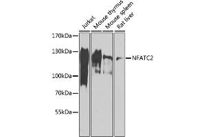 Western blot analysis of extracts of various cell lines, using NF antibody (ABIN6130583, ABIN6144556, ABIN6144557 and ABIN6218469) at 1:1000 dilution. (NFAT1 antibody  (AA 1-300))