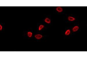 ABIN6274090 staining K562 by IF/ICC. (OVOL1 antibody  (N-Term))