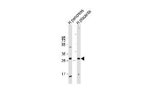 All lanes : Anti-P1R3E Antibody (Center) at 1:2000 dilution Lane 1: human pancreas lysate Lane 2: human placenta lysate Lysates/proteins at 20 μg per lane. (PPP1R3E antibody  (AA 159-192))
