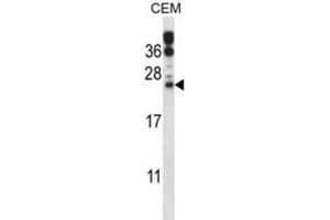 Western Blotting (WB) image for anti-RAB6B, Member RAS Oncogene Family (RAB6B) antibody (ABIN2997576) (RAB6B antibody)