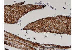 Immunoperoxidase of monoclonal antibody to FADS1 on formalin-fixed paraffin-embedded human skeletal muscle. (FADS1 antibody  (AA 1-99))