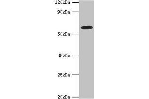 Western blot All lanes: STXBP4 antibody at 10 μg/mL + PC-3 whole cell lysate Secondary Goat polyclonal to rabbit IgG at 1/10000 dilution Predicted band size: 62, 27 kDa Observed band size: 62 kDa (STXBP4 antibody  (AA 344-553))