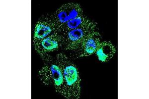 Confocal immunofluorescent analysis of TIMP1 Antibody (C-term) with A2058 cell followed by Alexa Fluor 488-conjugated goat anti-rabbit lgG (green).
