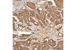 IHC analysis of SCO1 using anti-SCO1 antibody (ABIN7600609). (SCO1 antibody  (AA 21-301))