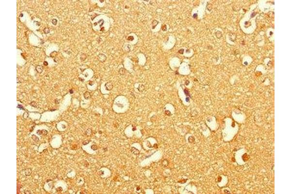 DBC1 antibody  (AA 20-320)