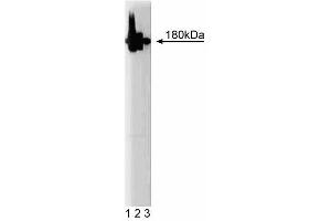 Western blot analysis of AP180 on a rat cerebrum lysate. (SNAP91 antibody  (AA 706-896))
