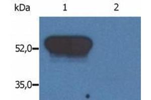 Western Blotting (WB) image for anti-Glial Fibrillary Acidic Protein (GFAP) antibody (ABIN238409) (GFAP antibody)