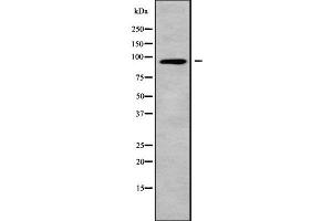 Western blot analysis of CNGB3 using A549 whole cell lysates (CNGB3 antibody  (N-Term))