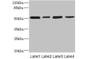 Western blot All lanes: CD276 antibody at 0. (CD276 antibody  (AA 29-200))