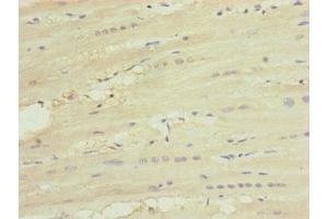Immunohistochemistry of paraffin-embedded human heart tissue using ABIN7174236 at dilution of 1:100 (MNF1 antibody  (AA 14-126))