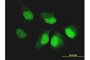 Immunofluorescence of monoclonal antibody to CASP14 on HeLa cell. (CASP14 antibody  (AA 133-242))