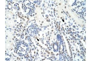 POGZ antibody was used for immunohistochemistry at a concentration of 4-8 ug/ml to stain EpitheliaI cells of renal tubule (arrows) in Human Kidney. (POGZ antibody  (N-Term))