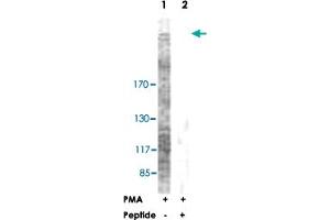 Western blot analysis of extracts from NIH/3T3 cells, treated with PMA (125 ng/ml, 30 mins), using ACACA polyclonal antibody . (Acetyl-CoA Carboxylase alpha antibody  (Ser79))