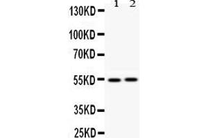 Western Blotting (WB) image for anti-Vimentin (VIM) (AA 435-466), (C-Term) antibody (ABIN3042344)