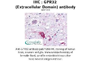 Image no. 1 for anti-G Protein-Coupled Receptor 32 (GPR32) (3rd Extracellular Domain) antibody (ABIN1735061) (GPR32 antibody  (3rd Extracellular Domain))