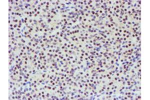 Image no. 3 for anti-TP53RK Binding Protein (TPRKB) antibody (ABIN1501485)