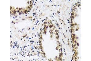 Immunohistochemistry of paraffin-embedded Human prostate using SAFB2 Polyclonal Antibody at dilution of 1:100 (40x lens). (SAFB2 antibody)