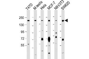 All lanes : Anti-PELP1 Antibody (Center ) at 1:1000 dilution Lane 1: T47D whole cell lysate Lane 2: mouse testis lysate Lane 3: Hela whole cell lysate Lane 4: MCF-7 whole cell lysate Lane 5: NIH/3T3 whole cell lysate Lane 6: S whole cell lysate Lysates/proteins at 20 μg per lane. (PELP1 antibody  (AA 744-771))