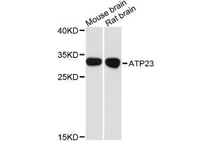 Western blot analysis of extracts of various cell lines, using ATP23 antibody. (XRCC6BP1 antibody)