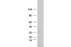 Western Blotting (WB) image for Caveolin 3 (CAV3) (Transcript Variant 1) protein (Myc-DYKDDDDK Tag) (ABIN2713247)