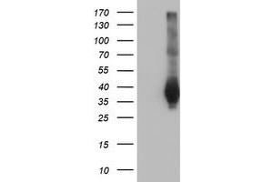 HEK293T cells were transfected with the pCMV6-ENTRY control (Left lane) or pCMV6-ENTRY FAM84B (Right lane) cDNA for 48 hrs and lysed. (FAM84B antibody)