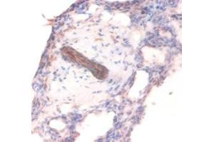 Immunohistochemistry of paraffin-embedded human lung tissue using ABIN7148208 at dilution of 1:100 (COL4A1 antibody  (AA 30-167))