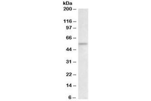 Western blot testing of rat thymus lysate with CHK1 antibody at 2ug/ml. (CHEK1 antibody)