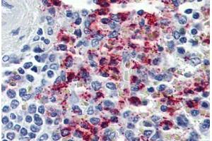 Anti-CYSLTR2 / CYSLT2 antibody  ABIN1048491 IHC staining of human spleen. (CasLTR2 antibody  (N-Term))