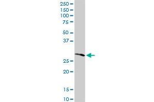 RPIA MaxPab rabbit polyclonal antibody. (Ribose 5-Phosphate Isomerase A (RPIA) (AA 1-237) antibody)