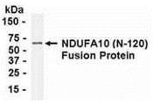 Western Blotting (WB) image for anti-NADH Dehydrogenase (Ubiquinone) 1 alpha Subcomplex, 10, 42kDa (NDUFA10) (AA 21-140) antibody (ABIN2468028) (NDUFA10 antibody  (AA 21-140))