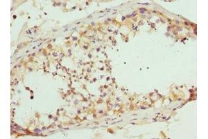 Immunohistochemistry of paraffin-embedded human testis tissue using ABIN7167404 at dilution of 1:100 (RASGRF1 antibody  (AA 1-190))