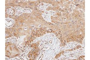 IHC-P Image Immunohistochemical analysis of paraffin-embedded SCC15 xenograft, using FAST, antibody at 1:100 dilution. (FASTK antibody  (C-Term))