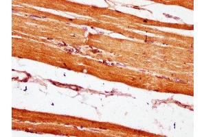 IHC image of ABIN7151067 diluted at 1:600 and staining in paraffin-embedded human skeletal muscle tissue performed on a Leica BondTM system. (MIB2 antibody  (AA 1-128))