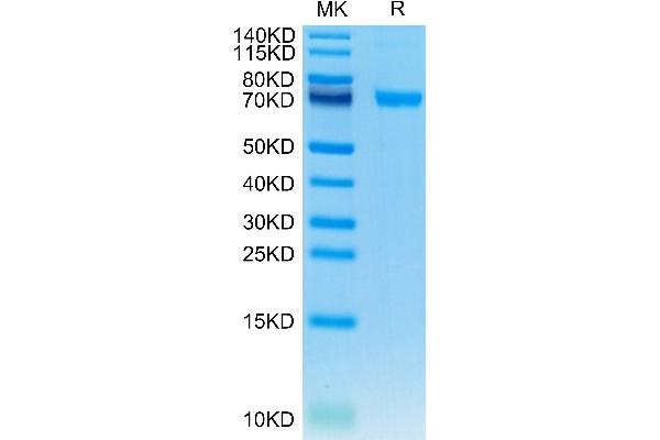 IL21 Receptor Protein (AA 20-236) (Fc Tag)