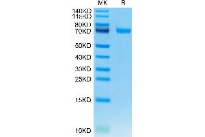 Human IL-21R on Tris-Bis PAGE under reduced condition. (IL21 Receptor Protein (AA 20-236) (Fc Tag))