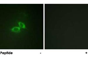 Immunofluorescence analysis of NIH/3T3 cells, using GRIN1 polyclonal antibody . (GRIN1/NMDAR1 antibody)