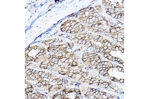Immunohistochemistry of paraffin-embedded rat stomach using GNB2 Rabbit pAb  at dilution of 1:100 (40x lens). (GNB2 antibody  (AA 1-340))
