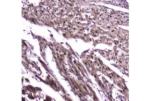 Immunohistochemistry (IHC) image for anti-Nuclear Factor I/B (NFIB) antibody (ABIN5692906)