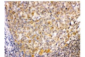IHC analysis of TRIB2 using anti-TRIB2 antibody (ABIN3044555). (TRIB2 antibody  (Middle Region))